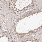 Merck Anti-CDC123 antibody produced in rabbit