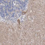 Merck Anti-ANKRD16 antibody produced in rabbit