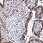 Merck Anti-SH3PXD2A antibody produced in rabbit