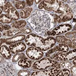 Merck Anti-DHTKD1 antibody produced in rabbit