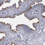 Merck Anti-AGBL4 antibody produced in rabbit