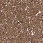 Merck Anti-ADCY2 antibody produced in rabbit