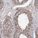 Merck Anti-PTDSS2 antibody produced in rabbit