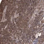 Merck Anti-MEPE antibody produced in rabbit