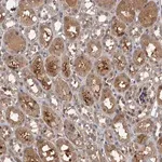Merck Anti-SNX15 antibody produced in rabbit