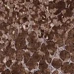 Merck Anti-LCOR antibody produced in rabbit