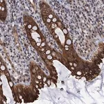 Merck Anti-ABLIM1 antibody produced in rabbit
