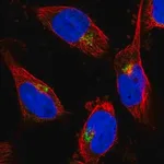 Merck Anti-CYB5R2 antibody produced in rabbit
