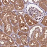 Merck Anti-ETFBKMT antibody produced in rabbit