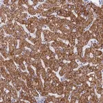 Merck Anti-MMAB antibody produced in rabbit