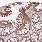 Merck Anti-VPS11 antibody produced in rabbit