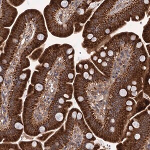 Merck Anti-DYNC2H1 antibody produced in rabbit