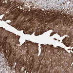Merck Anti-ACAP2 antibody produced in rabbit