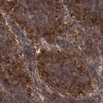 Merck Anti-PATL1 antibody produced in rabbit