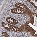 Merck Anti-RITA1 antibody produced in rabbit