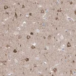 Merck Anti-GTPBP8 antibody produced in rabbit