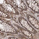 Merck Anti-ACAP2 antibody produced in rabbit