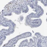 Merck Anti-ZCCHC12 antibody produced in rabbit