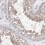 Merck Anti-AURKC antibody produced in rabbit