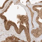 Merck Anti-XRN1 antibody produced in rabbit