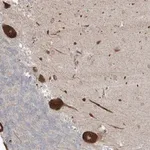 Merck Anti-ZNF263 antibody produced in rabbit