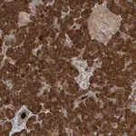 Merck Anti-KIAA0556 antibody produced in rabbit