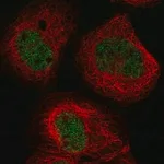 Merck Anti-BTBD8 antibody produced in rabbit