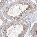 Merck Anti-MAP4K5 antibody produced in rabbit