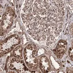 Merck Anti-FANCL antibody produced in rabbit