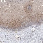 Merck Anti-INPP1 antibody produced in rabbit