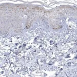 Merck Anti-NIPAL1 antibody produced in rabbit