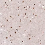 Merck Anti-SORBS2 antibody produced in rabbit