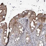 Merck Anti-SCN11A antibody produced in rabbit