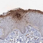 Merck Anti-TANC1 antibody produced in rabbit