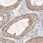 Merck Anti-ANKS1A antibody produced in rabbit