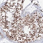 Merck Anti-ZNF638 antibody produced in rabbit
