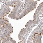 Merck Anti-DNAH1 antibody produced in rabbit