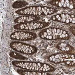 Merck Anti-QTRT2 antibody produced in rabbit