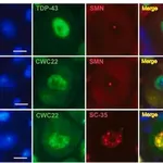 Merck Anti-CWC22 antibody produced in rabbit