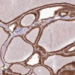 Merck Anti-PPP1R21 antibody produced in rabbit