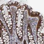 Merck Anti-PDSS1 antibody produced in rabbit