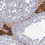 Merck Anti-LPIN1 antibody produced in rabbit