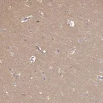 Merck Anti-MED12L antibody produced in rabbit