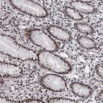 Merck Anti-METTL12 antibody produced in rabbit