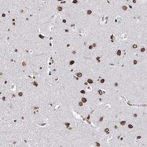 Merck Anti-KIAA0930 antibody produced in rabbit