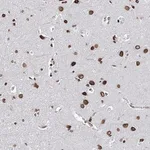 Merck Anti-KIAA0930 antibody produced in rabbit