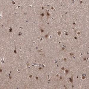 Merck Anti-TSHZ2 antibody produced in rabbit