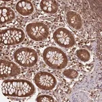 Merck Anti-NPRL2 antibody produced in rabbit