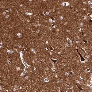 Merck Anti-DMXL2 antibody produced in rabbit