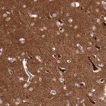 Merck Anti-DMXL2 antibody produced in rabbit